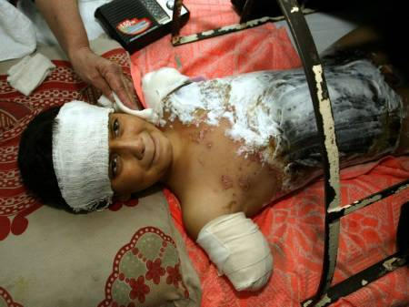 [cluster_bomb_victim.jpg]