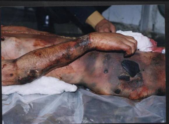 [iraq+torture.jpg]