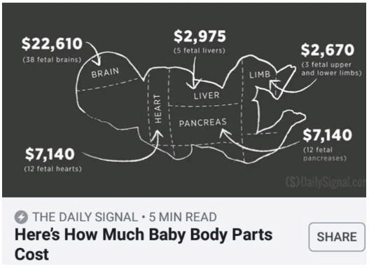 baby parts