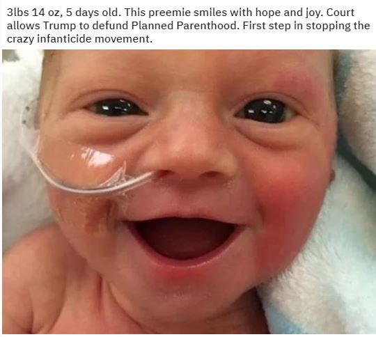premature baby.JPG