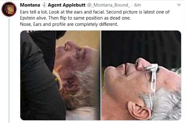epstein ears 2.JPG