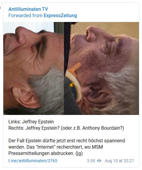 epstein ears