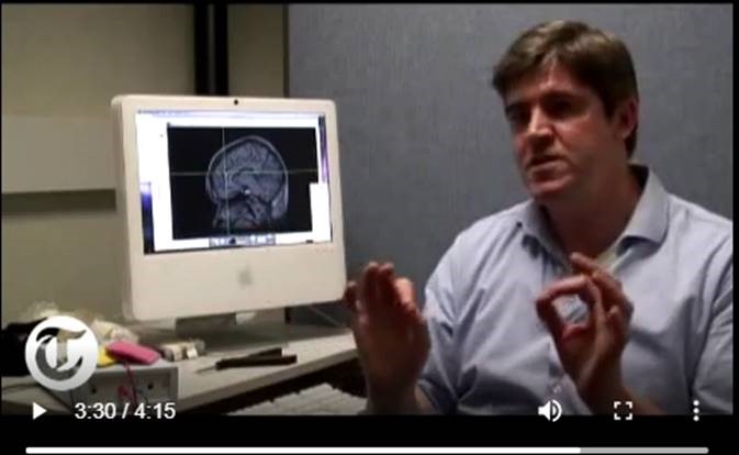 brain scan 2