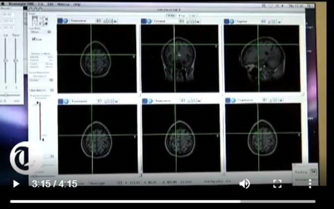brain scan