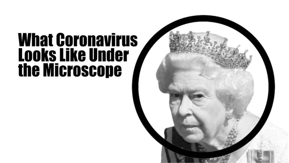 queen microscope coronavirus