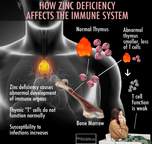 zinc deficiency