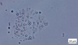 COVID vax contents aggregation