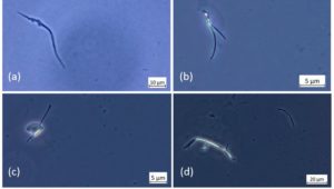 COVID vax contents fibers threads