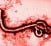 ebola virus microscope globalresearch.ca